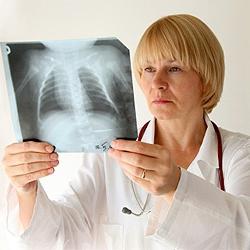 Pagrindiniai plaučių tuberkuliozės simptomai suaugusiems
